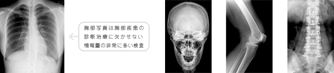 一般Ⅹ線写真