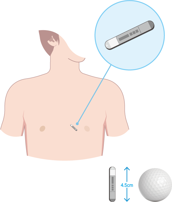繰り返す原因不明の失神や原因不明の脳梗塞に対して