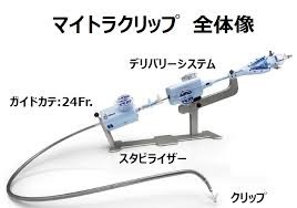 Mitral clipの実際