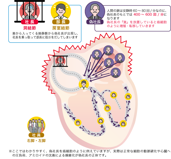心房細動の病態
