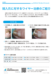 陥入爪に対するワイヤー治療のご紹介