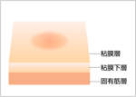 手技の流れ