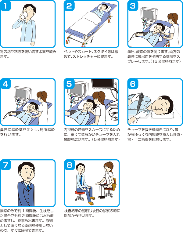 経口内視鏡 口から入れる胃内視鏡検査 検査の流れ
