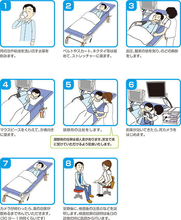 経口内視鏡 口から入れる胃内視鏡検査 検査の流れ