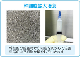 組織の輸送および細胞培養
