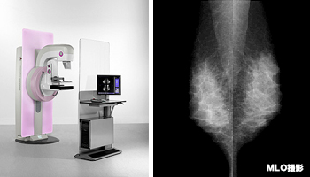 乳房撮影装置 マンモグラフィ