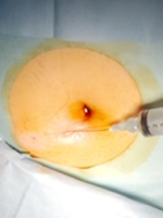 間葉系幹細胞の製造工程2