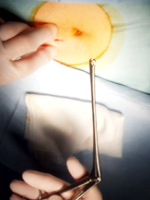 間葉系幹細胞の製造工程4