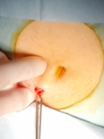 間葉系幹細胞の製造工程5