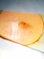 間葉系幹細胞の製造工程6