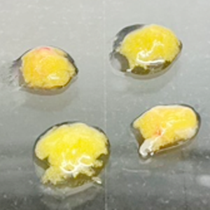 採取した脂肪を細断し分離基材へ