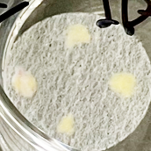 採取した脂肪を細断し分離基材へ