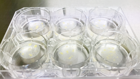 採取した脂肪を細断し分離基材へ