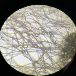 採取した脂肪を細断し分離基材へ
