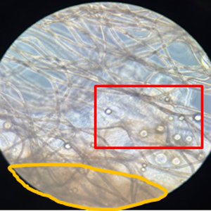 採取した脂肪を細断し分離基材へ
