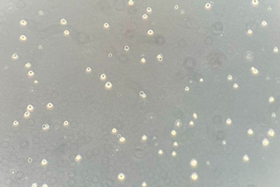 約2週間の拡大培養へ(day0)