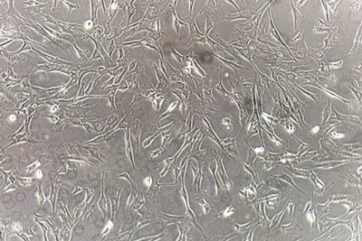 約2週間の拡大培養へ(day2)