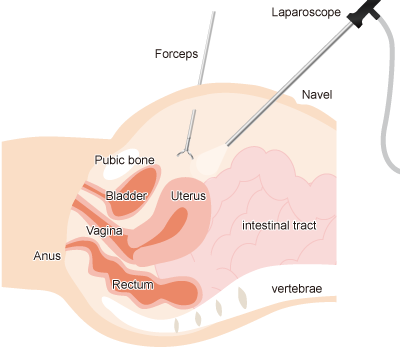 Insertion Routes of Medical Instruments