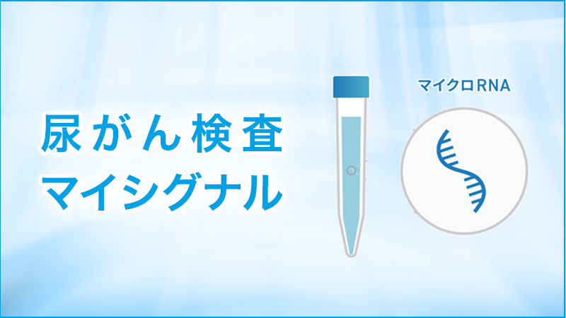 尿がん検査マイシグナル