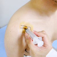 組織の輸送および細胞培養